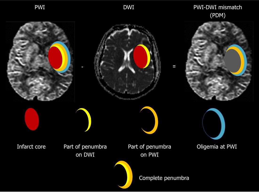 dwi schematic diagram mri