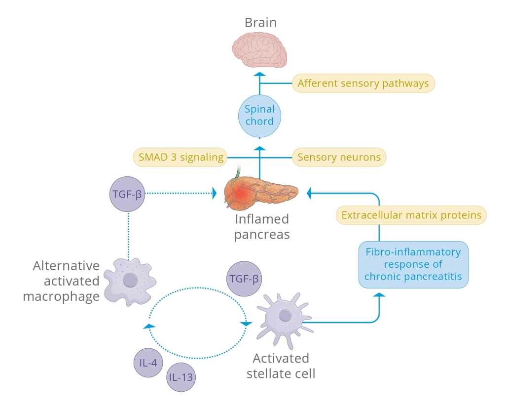 pancreatitis pathophysiology schematic diagram