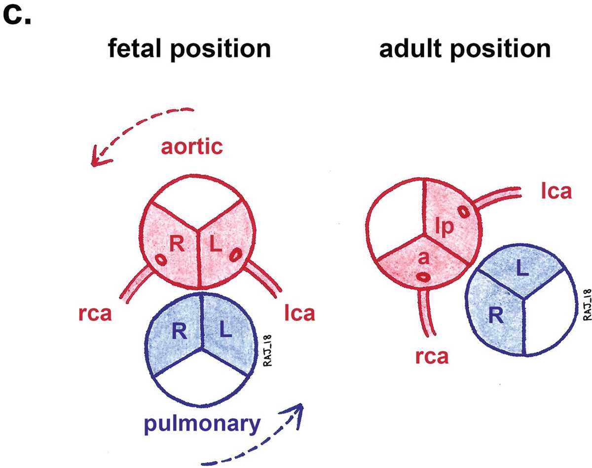 schematic diagram of coronary circulation
