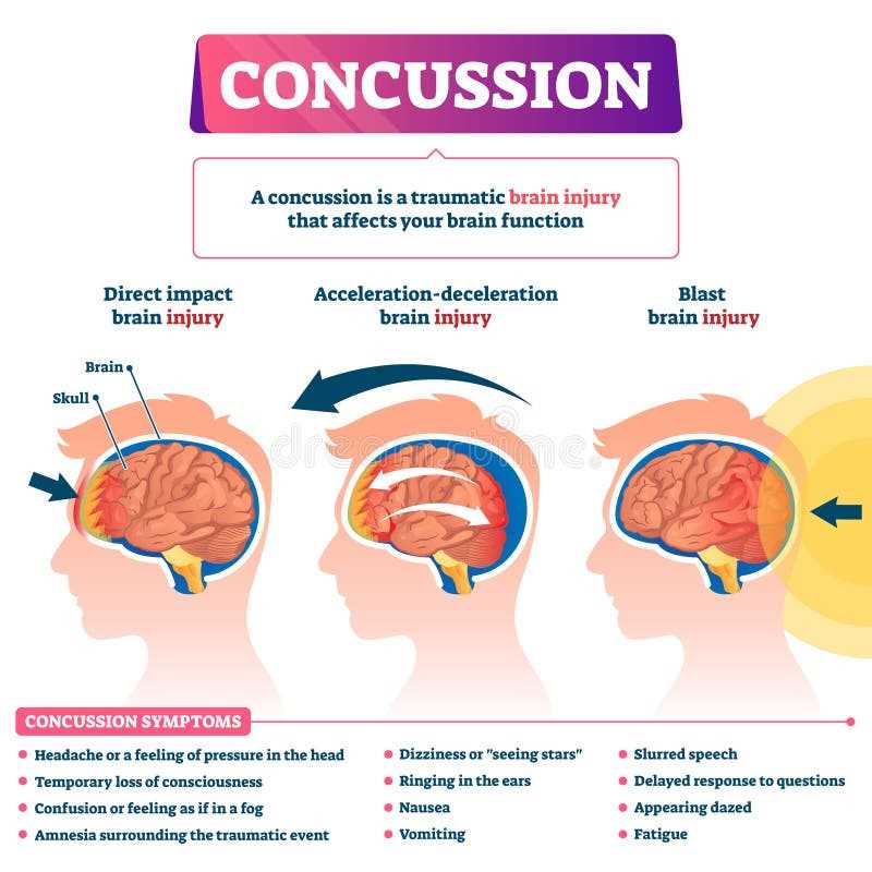 schematic diagram of head injury