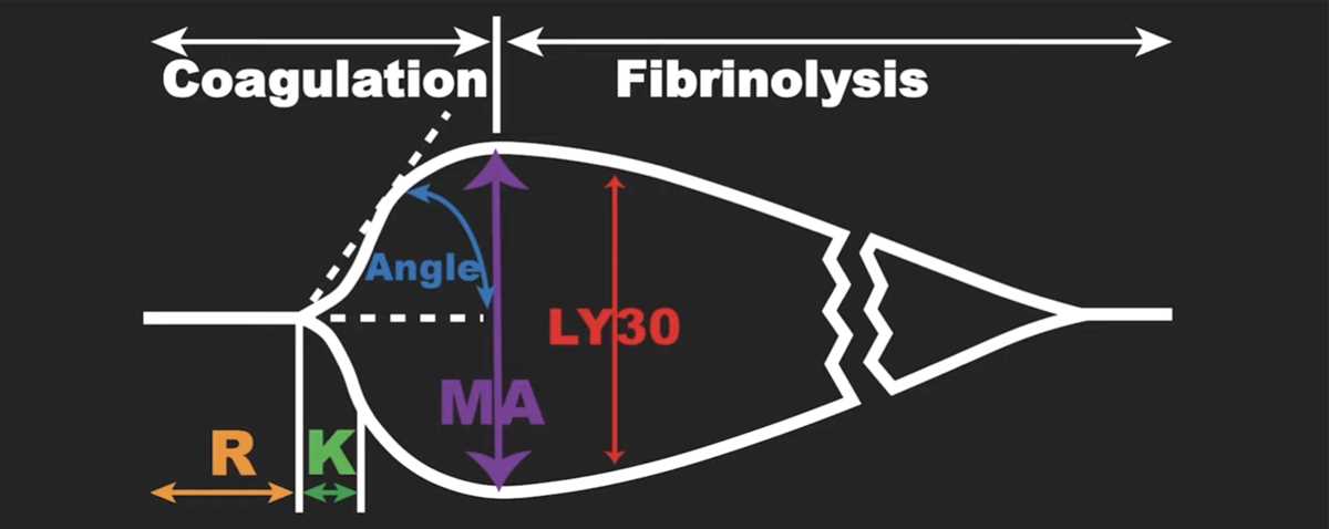 thromboelastography schematic diagram