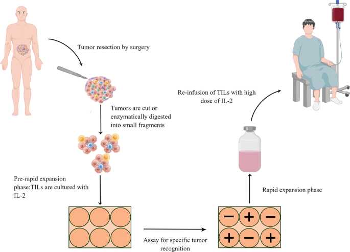 schematic diagram of adoptive cell transfer