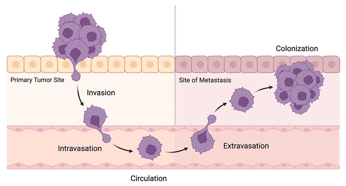 schematic diagram of cancer