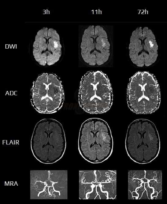 dwi schematic diagram mri