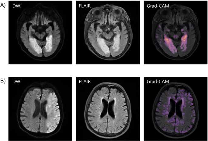 dwi schematic diagram mri