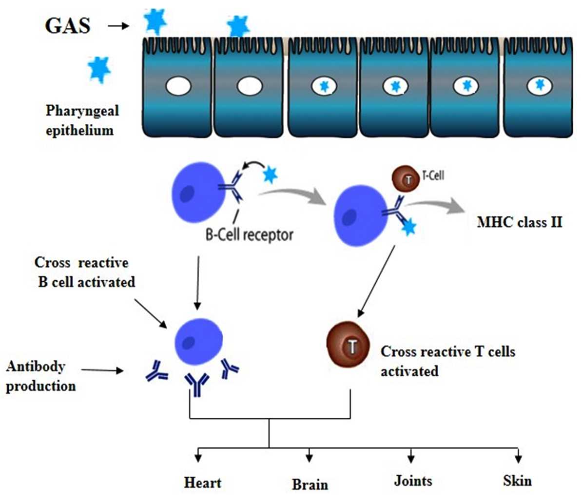 rheumatic fever pathophysiology schematic diagram