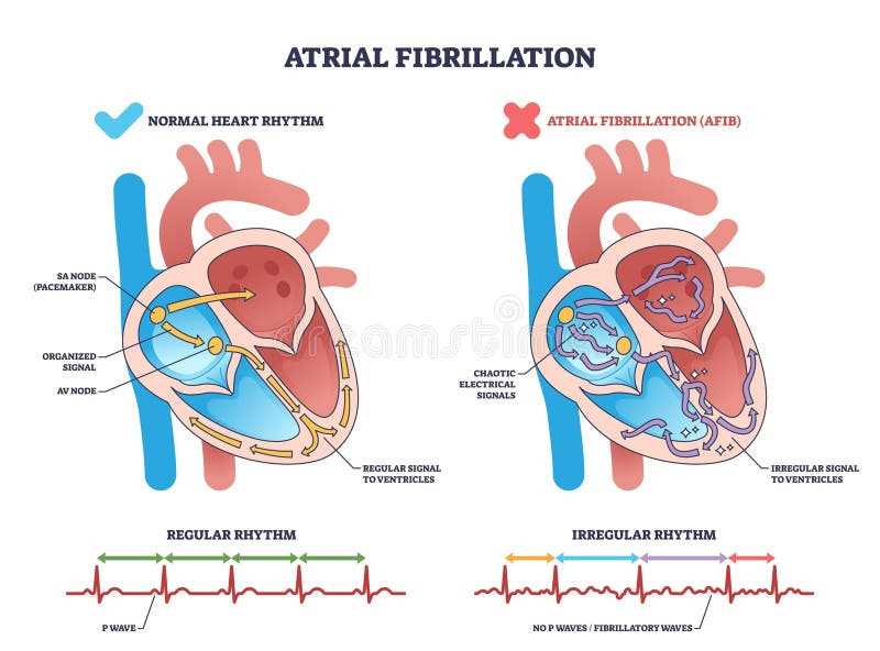 heartbeat schematic diagram