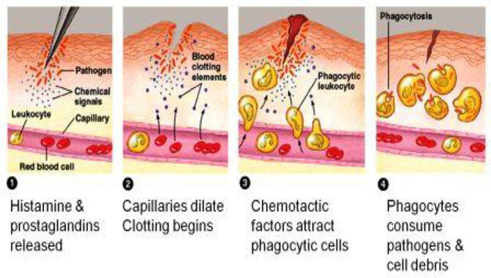 inflammation schematic diagram