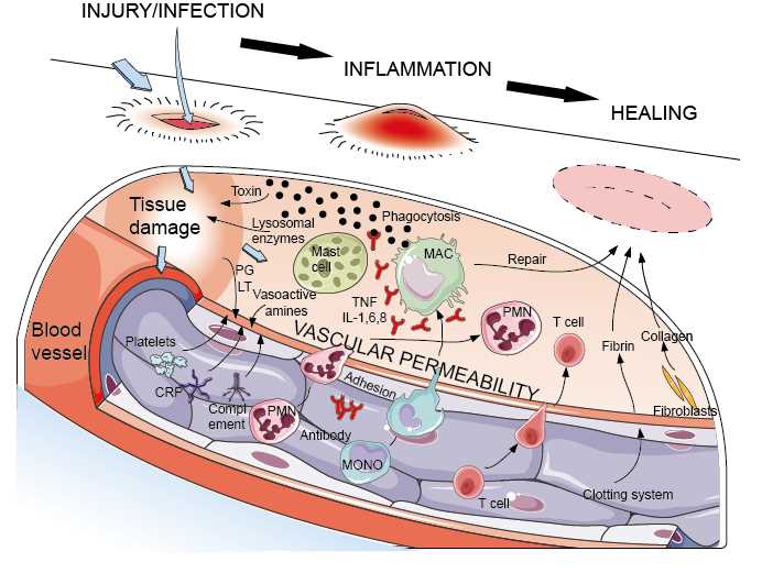 inflammatory process schematic diagram