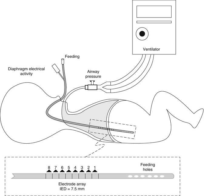 ventilator schematic diagram ventilator schematic diagram