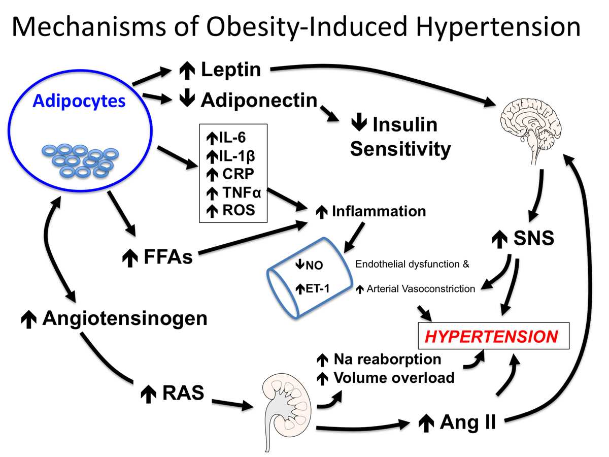 pathophysiology of hypertension schematic diagram