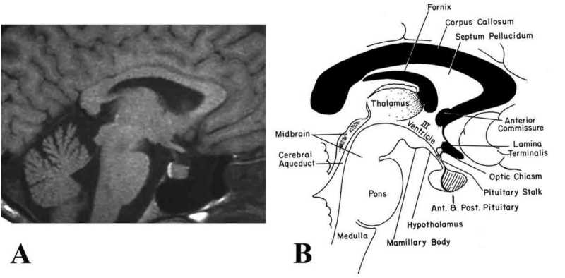 pituitary gland schematic diagram