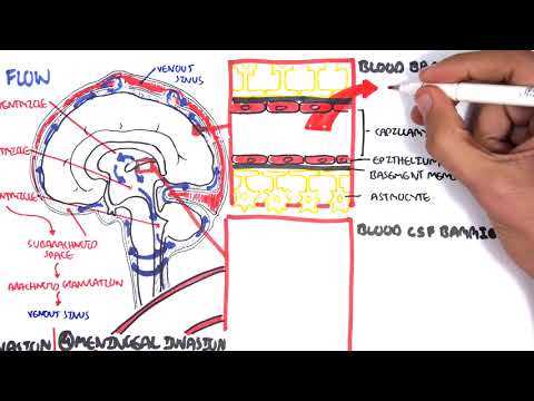 pathophysiology of meningitis schematic diagram