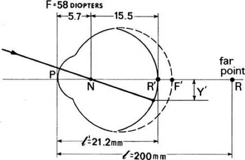 schematic eye diagram