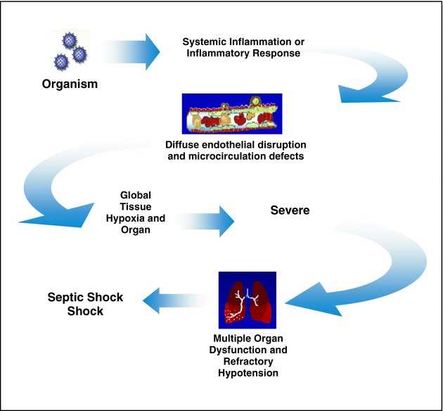 septic shock schematic diagram