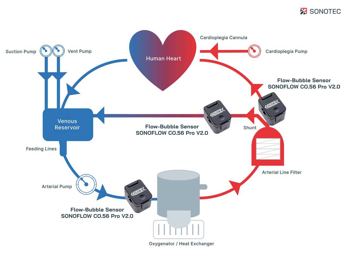 heart lung machine circuit diagram heart lung machine circuit diagram