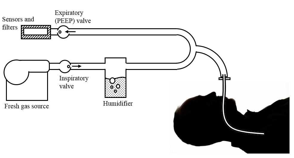 ventilator schematic diagram ventilator schematic diagram