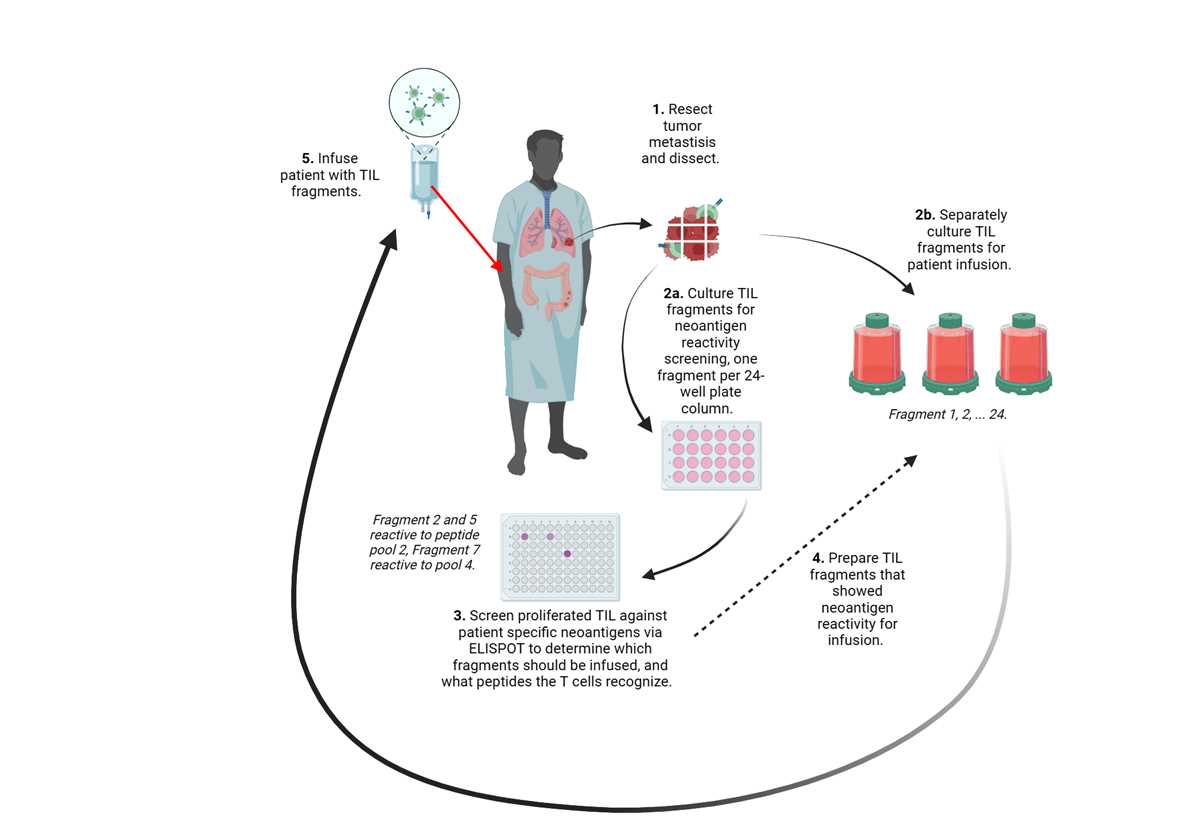 schematic diagram of adoptive cell transfer
